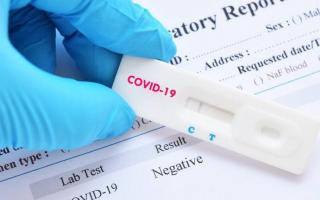 O‘zbekistonda koronavirusga test oluvchi xususiy klinikalar ro‘yxati e’lon qilindi