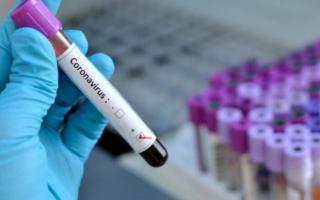 Jomboydagi 29 ta mahallada koronavirus aniqlangani ma’lum bo‘ldi