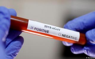 Andijonda yana 31 kishida koronavirus aniqlandi