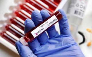 Toshkent shahrida yana 125 kishida koronavirus aniqlandi