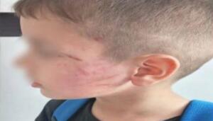 Бухорода боғча боласини калтаклаган эркак жавобгарликка тортилди