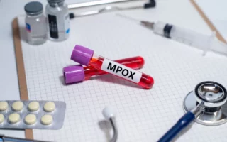 Германияда mpox вирусининг хавфли штамми билан касалланганлар аниқланди