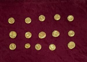 Тошкент халқаро аэропортида 2 аёл олтинни жинсий аъзосига яшириб олиб ўтишга уринди