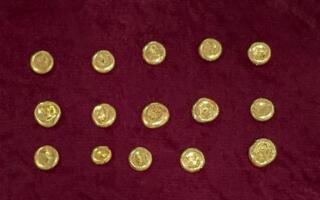Тошкент халқаро аэропортида 2 аёл олтинни жинсий аъзосига яшириб олиб ўтишга уринди
