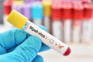 Санэпидқўмита Ўзбекистон фуқароларини Нипах вируси бўйича огоҳлантирди