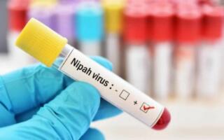 Санэпидқўмита Ўзбекистон фуқароларини Нипах вируси бўйича огоҳлантирди