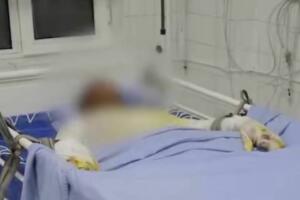 Чирчиқда поезд вагони устида селфига тушмоқчи бўлган 17 ёшли ўсмирни ток урди