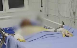 Чирчиқда поезд вагони устида селфига тушмоқчи бўлган 17 ёшли ўсмирни ток урди