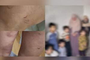 Тошкентда болаларни жароҳатлаб, мажбурий равишда диний сабоқ берганлар ушланди