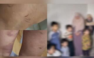 Тошкентда болаларни жароҳатлаб, мажбурий равишда диний сабоқ берганлар ушланди